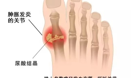 小儿咳嗽糖浆用药几天网 - 小儿咳嗽糖浆用药几天有效果,小儿咳嗽糖浆吃几天